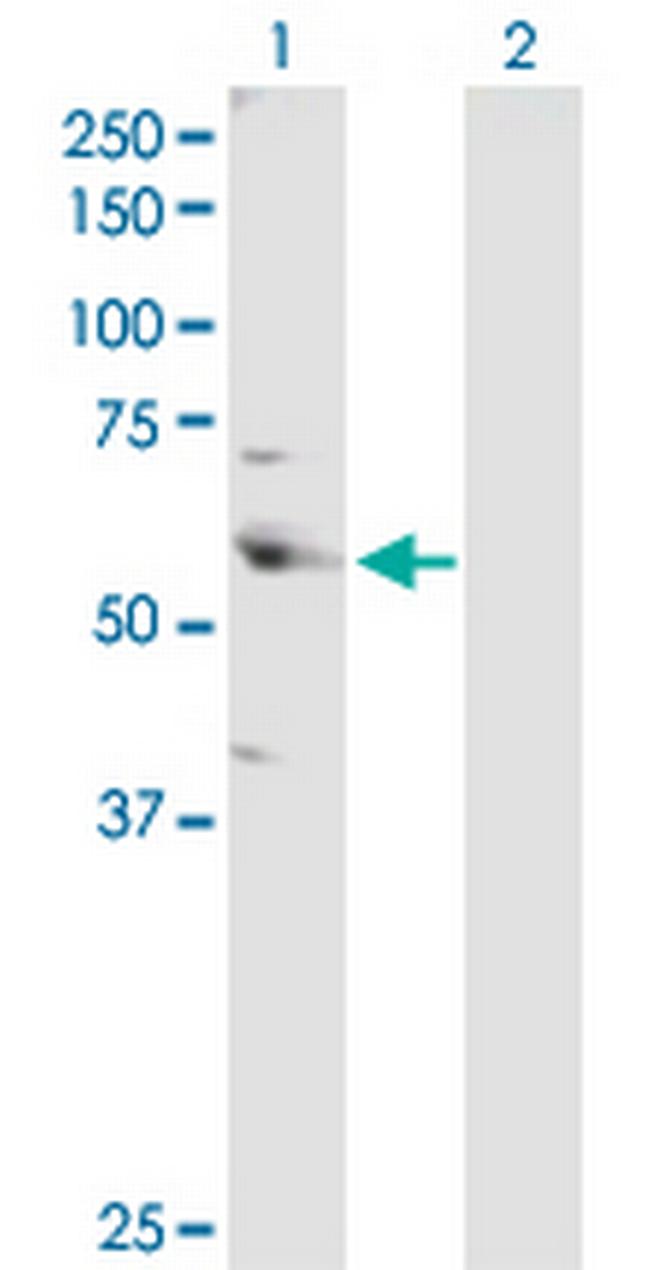 CSTF2 Antibody in Western Blot (WB)