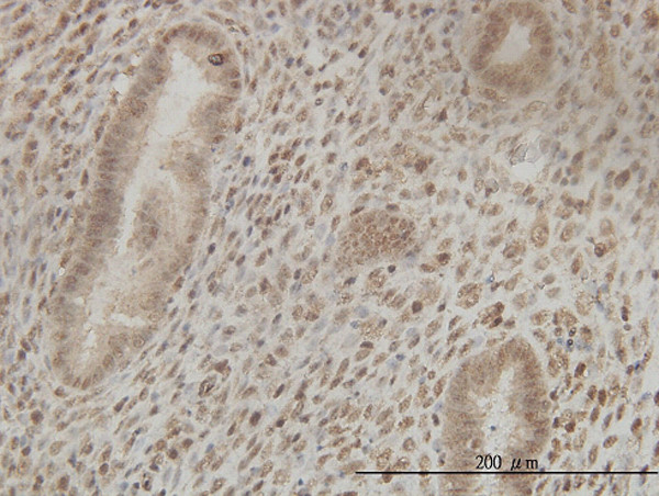 CSTF2 Antibody in Immunohistochemistry (Paraffin) (IHC (P))