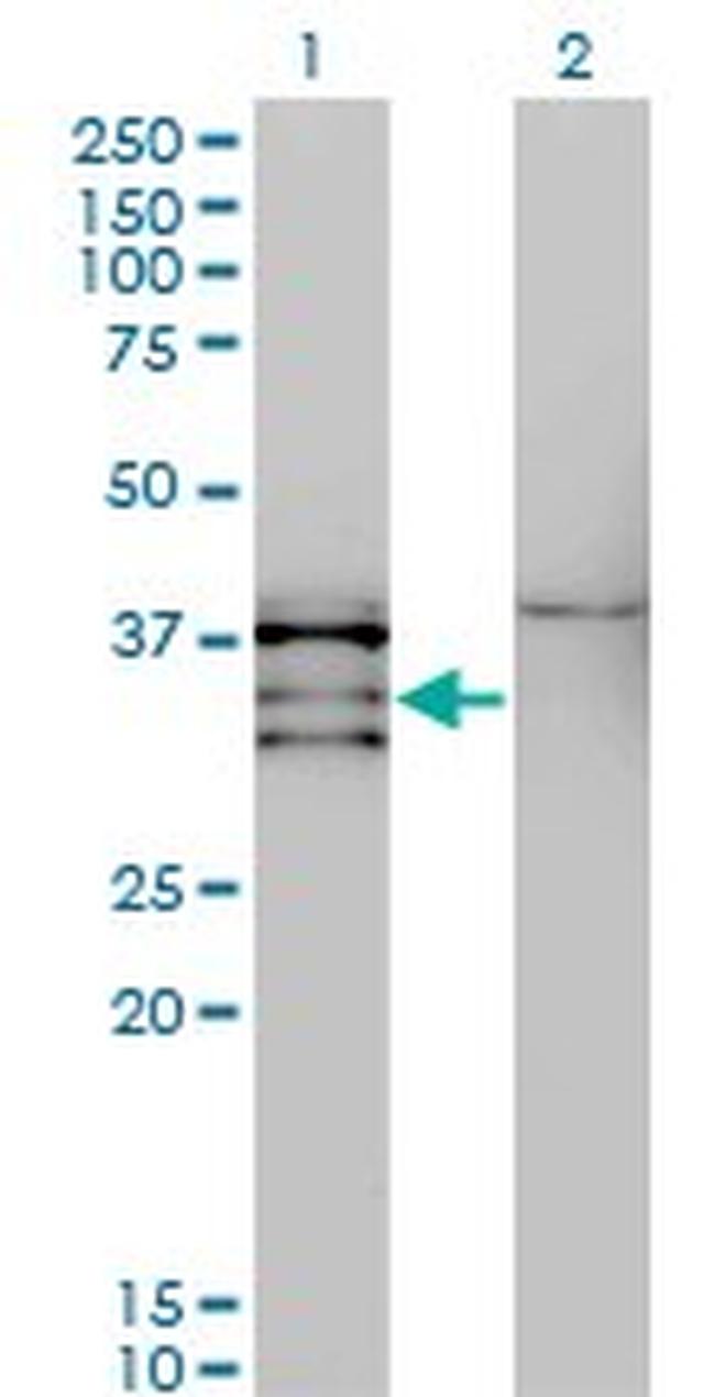 NKX2-5 Antibody in Western Blot (WB)