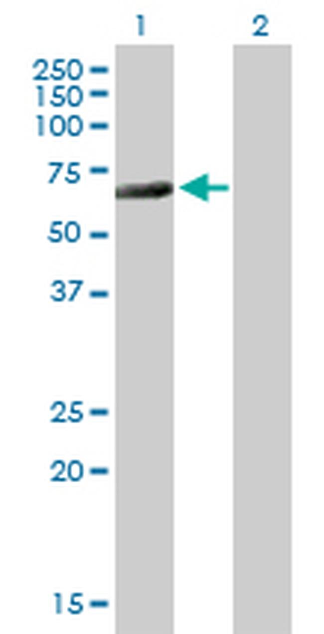 CTBP2 Antibody in Western Blot (WB)