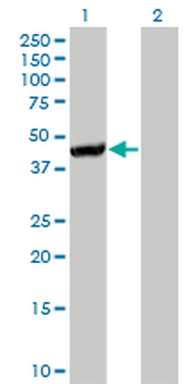 CTH Antibody in Western Blot (WB)
