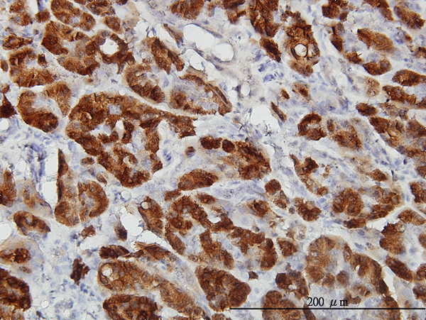 CTH Antibody in Immunohistochemistry (Paraffin) (IHC (P))