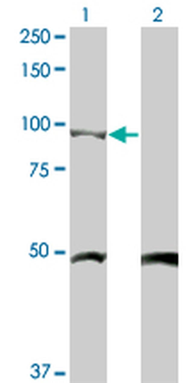 CTNNB1 Antibody in Western Blot (WB)