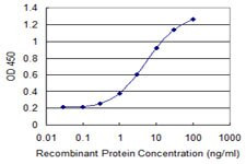 CTNNB1 Antibody in ELISA (ELISA)