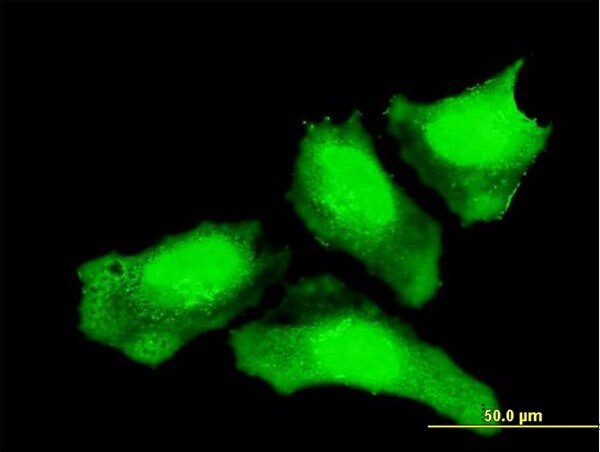 CTNNB1 Antibody in Immunocytochemistry (ICC/IF)