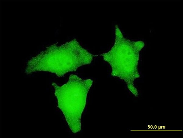 CTNNB1 Antibody in Immunocytochemistry (ICC/IF)