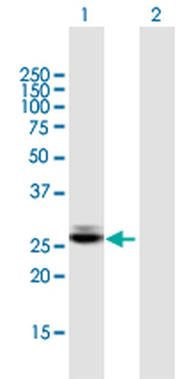 CTRB1 Antibody in Western Blot (WB)