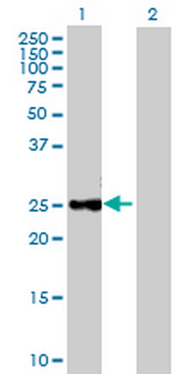 CTRB1 Antibody in Western Blot (WB)