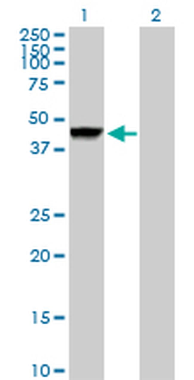 CTSD Antibody in Western Blot (WB)