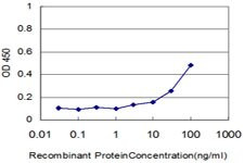 CTSD Antibody in ELISA (ELISA)