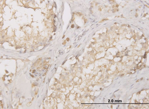 CTSD Antibody in Immunohistochemistry (Paraffin) (IHC (P))
