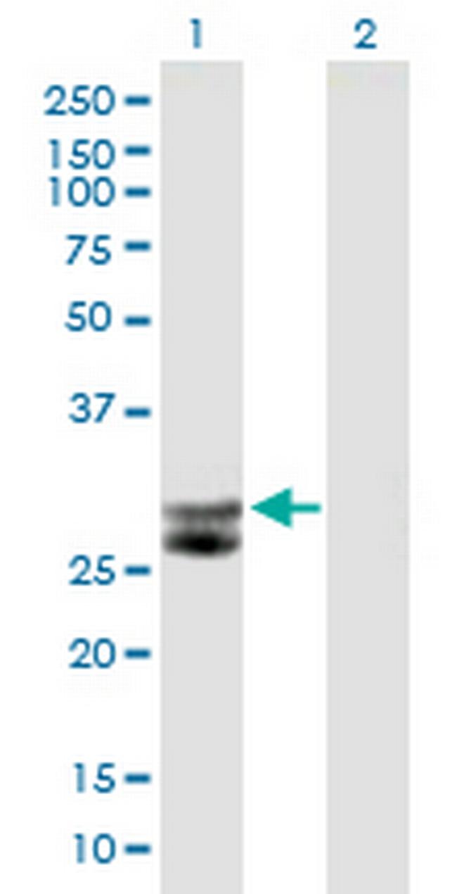 CTSG Antibody in Western Blot (WB)