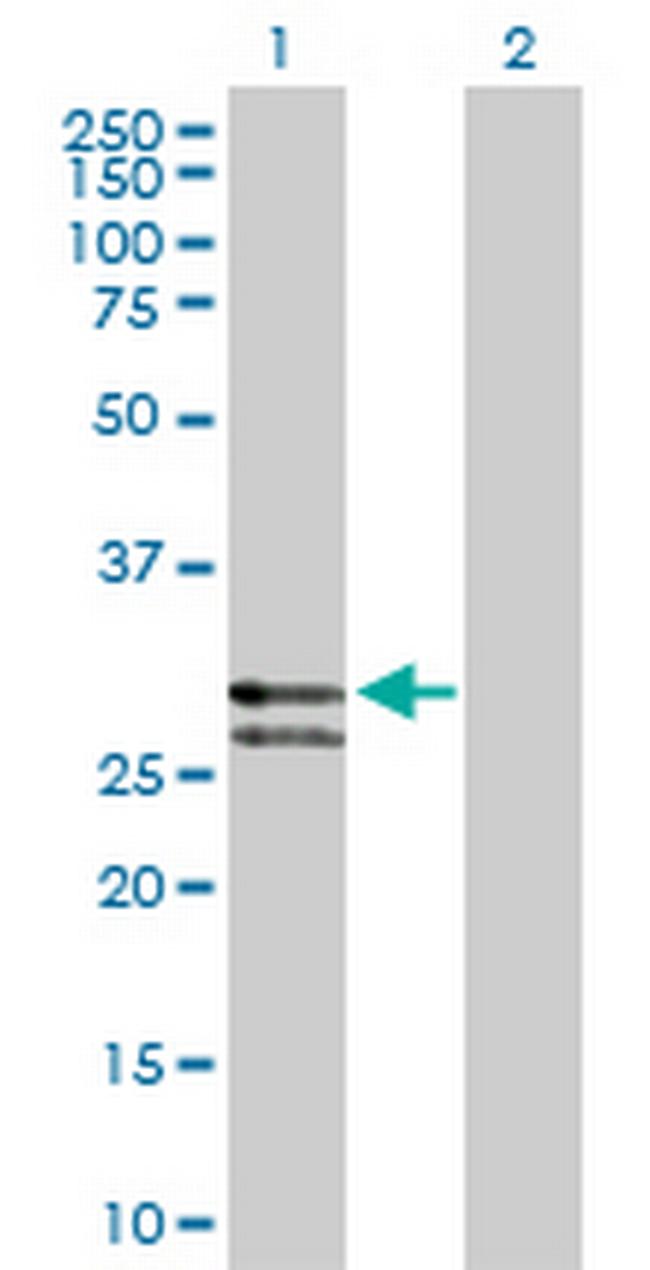 CTSG Antibody in Western Blot (WB)
