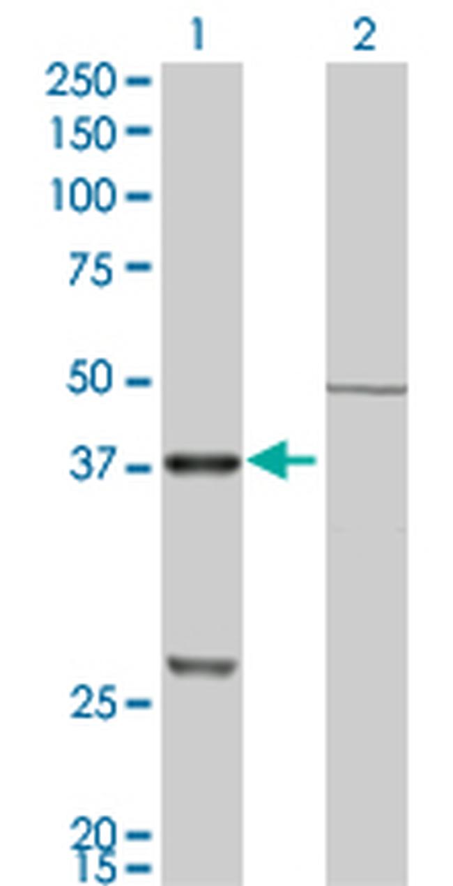 CTSK Monoclonal Antibody (2F1) | Invitrogen (H00001513-M01)