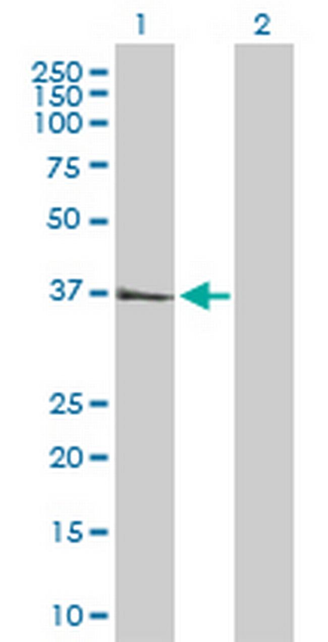CTSS Antibody in Western Blot (WB)