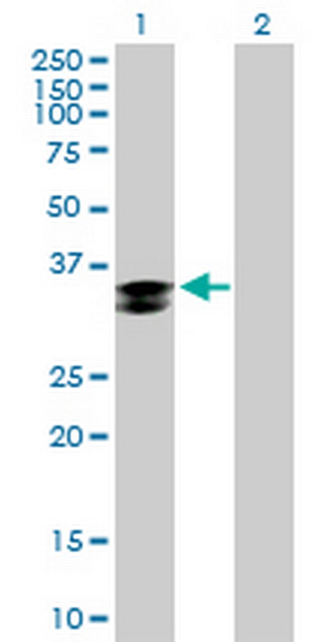 CTSZ Antibody in Western Blot (WB)