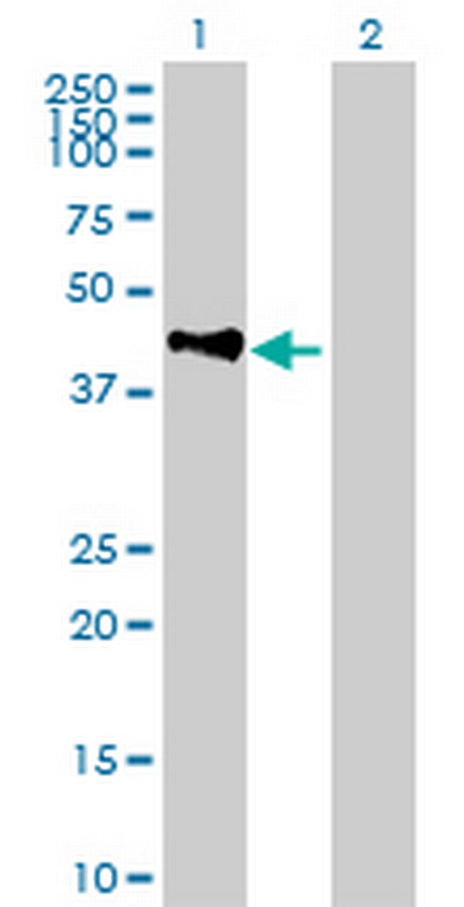 CXorf2 Antibody in Western Blot (WB)