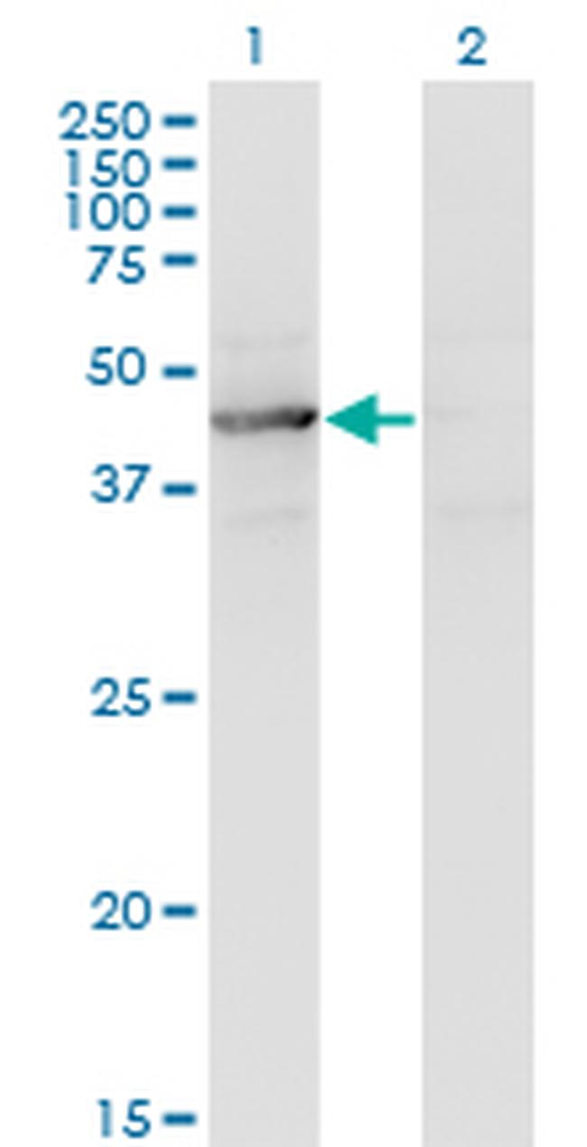 TEX28 Antibody in Western Blot (WB)