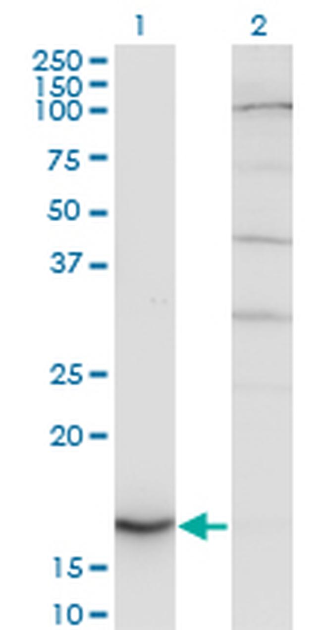 CYB5A Antibody in Western Blot (WB)