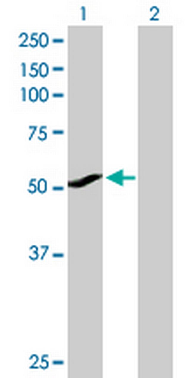 CYP1A1 Antibody in Western Blot (WB)