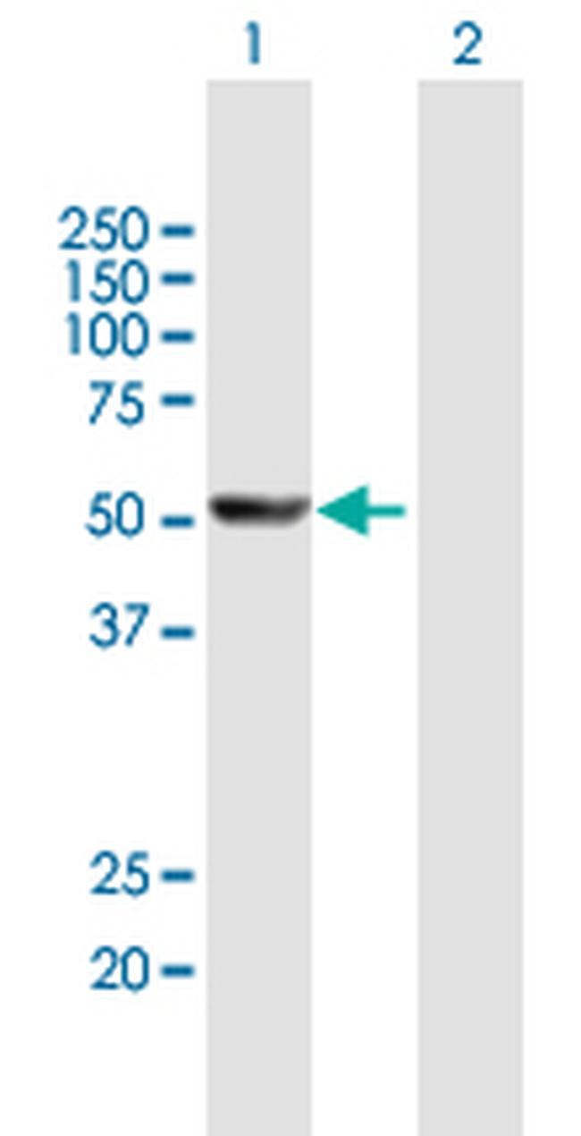 CYP1A2 Antibody in Western Blot (WB)