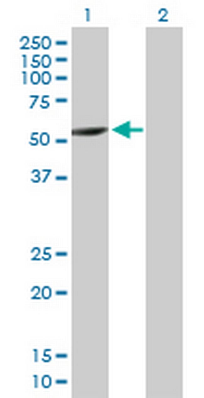 CYP2A7 Antibody in Western Blot (WB)