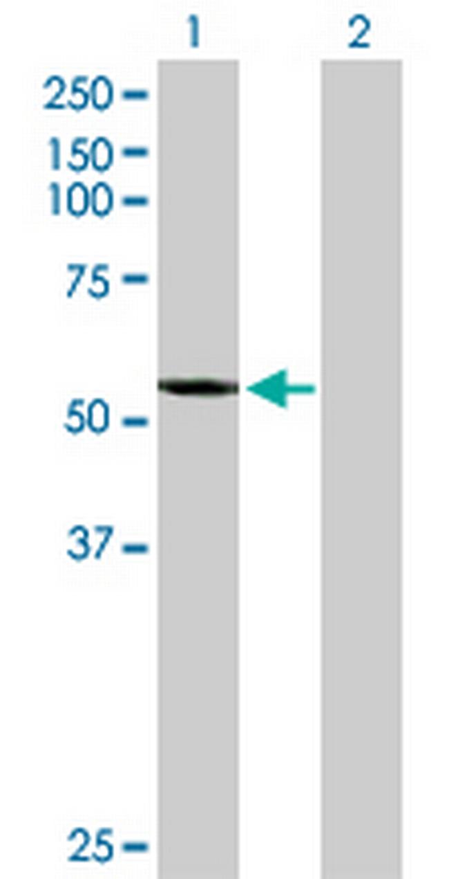 CYP2A7 Antibody in Western Blot (WB)