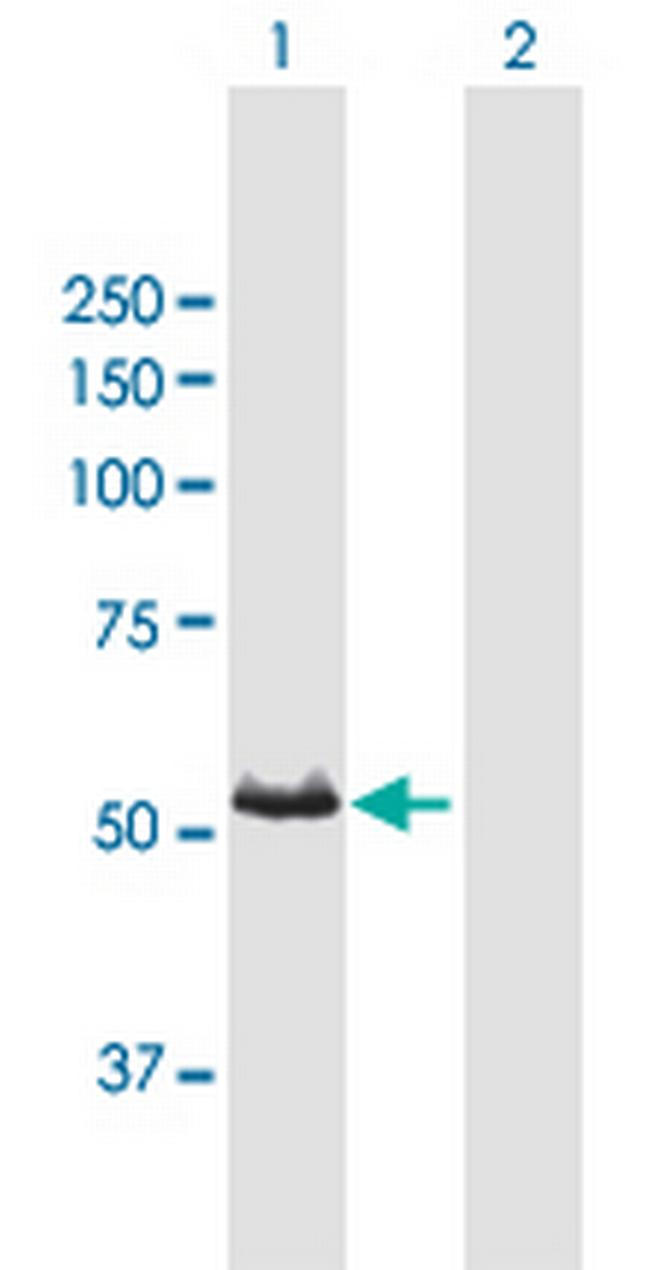 CYP3A7 Antibody in Western Blot (WB)