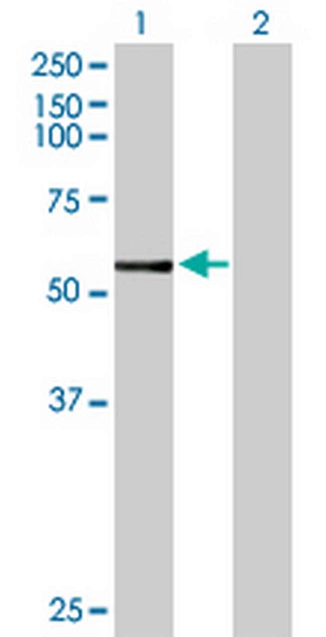 CYP3A7 Antibody in Western Blot (WB)