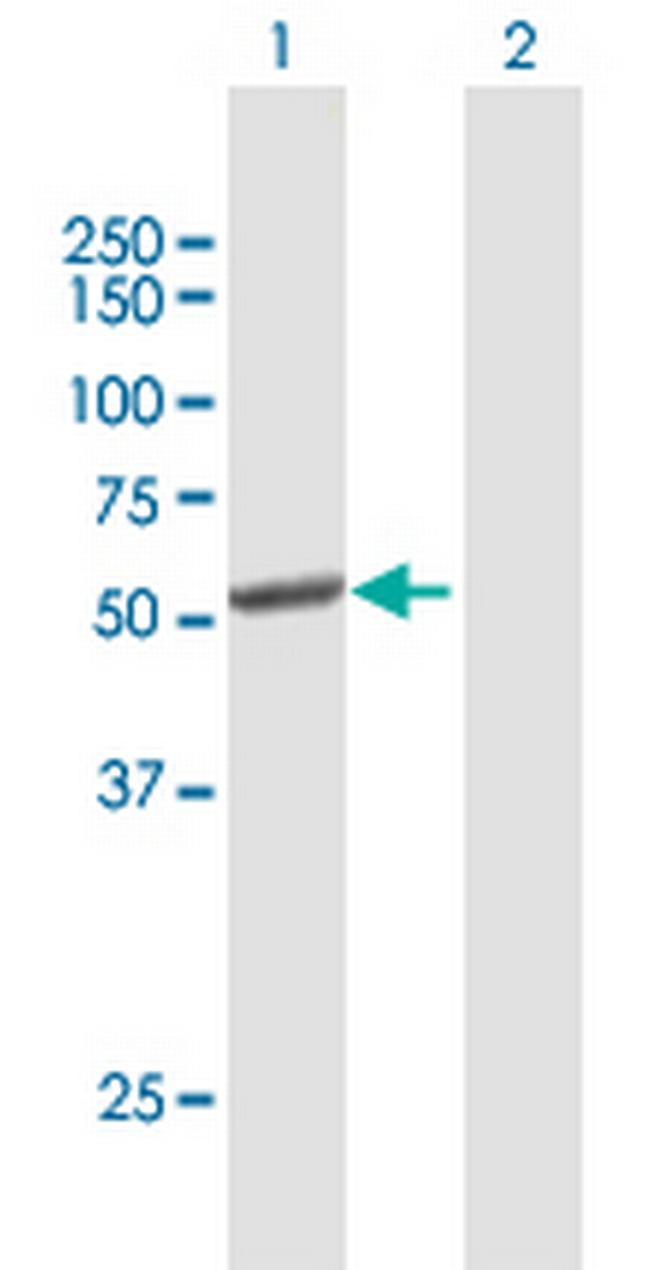 CYP2C8 Antibody in Western Blot (WB)