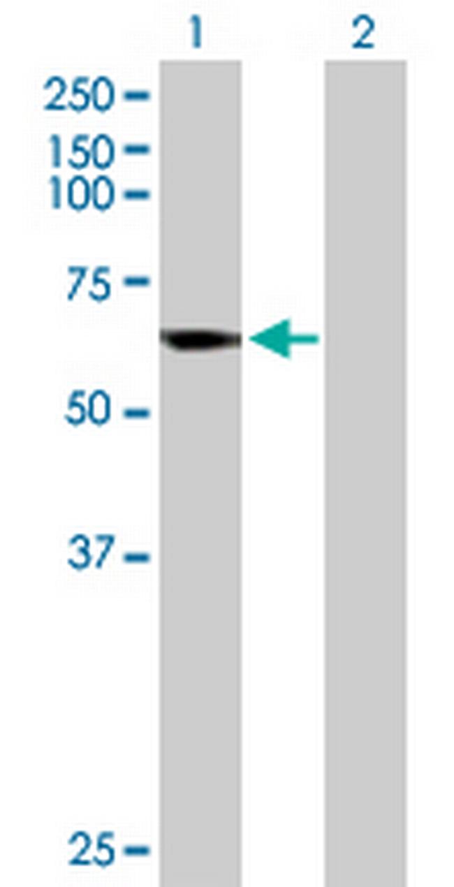 CYP4B1 Antibody in Western Blot (WB)
