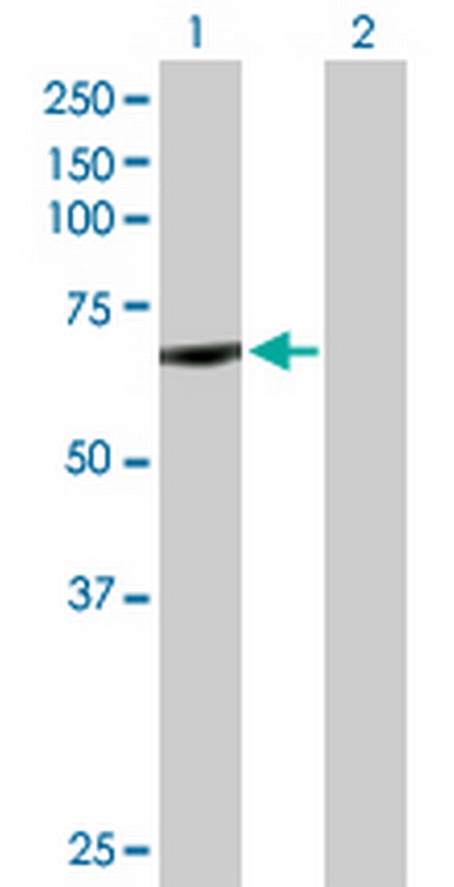 CYP11B1 Antibody in Western Blot (WB)