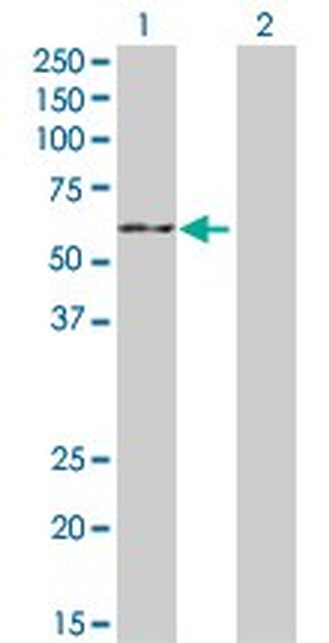 CYP19A1 Antibody in Western Blot (WB)
