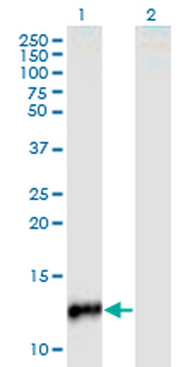 CYP24A1 Antibody in Western Blot (WB)