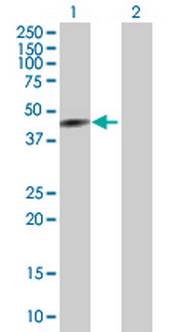 CYP26A1 Antibody in Western Blot (WB)