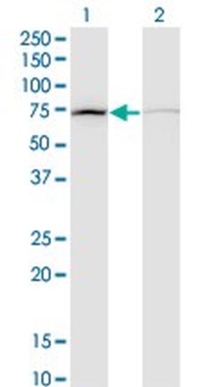 DAB2 Antibody in Western Blot (WB)