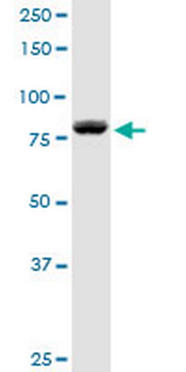DGKA Antibody in Western Blot (WB)