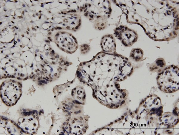 DGKA Antibody in Immunohistochemistry (Paraffin) (IHC (P))