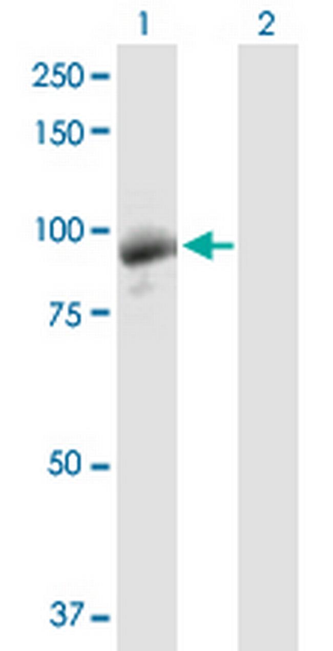 DGKG Antibody in Western Blot (WB)