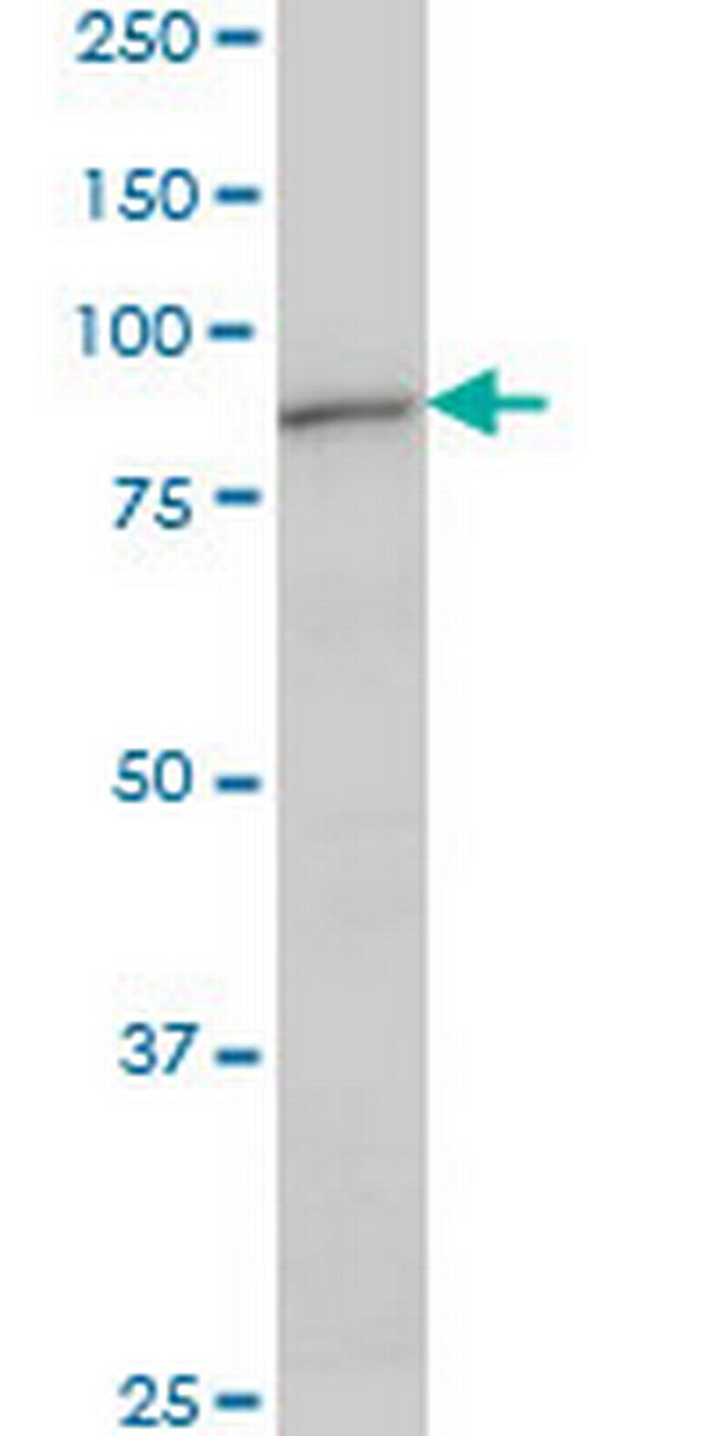 DAZ1 Antibody in Western Blot (WB)