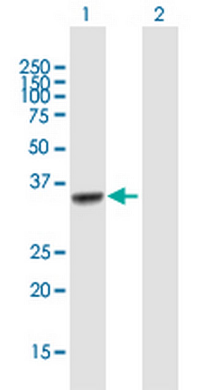 DBC1 Antibody in Western Blot (WB)