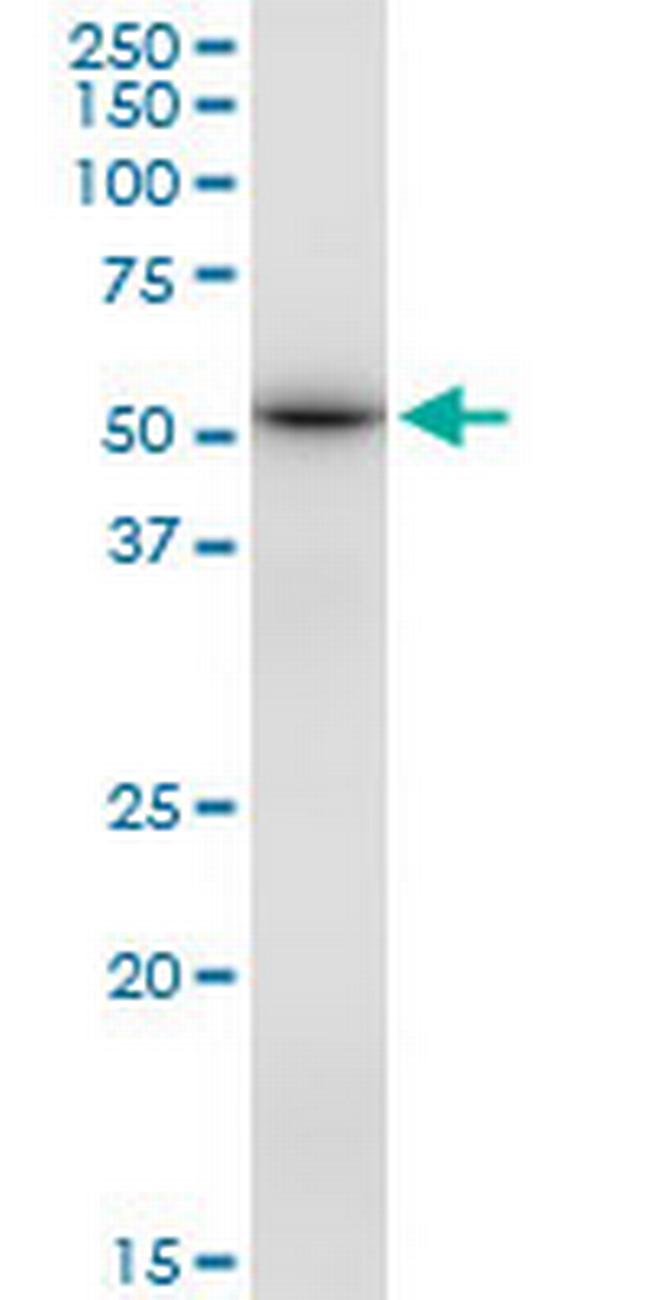 DBT Antibody in Western Blot (WB)