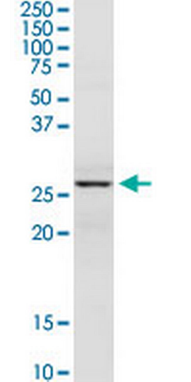 DCI Antibody in Western Blot (WB)