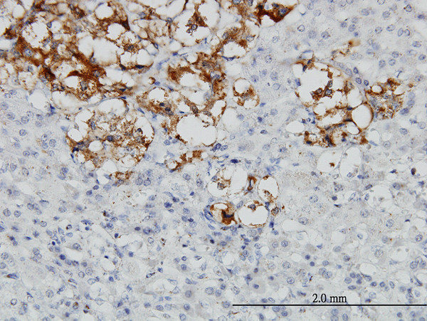 DCN Antibody in Immunohistochemistry (Paraffin) (IHC (P))