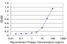 ACE Antibody in ELISA (ELISA)