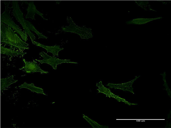 ACE Antibody in Immunocytochemistry (ICC/IF)