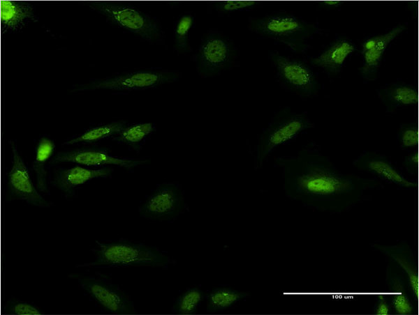DDB1 Antibody in Immunocytochemistry (ICC/IF)