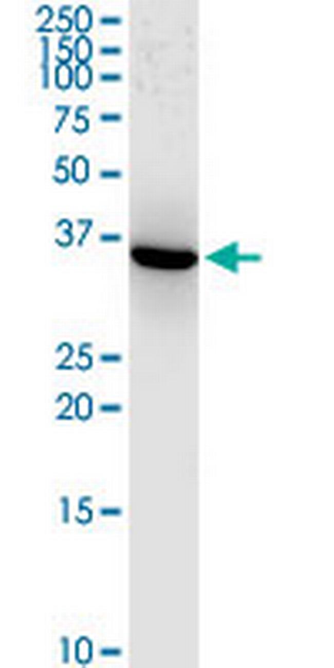 AKR1C1 Antibody in Western Blot (WB)