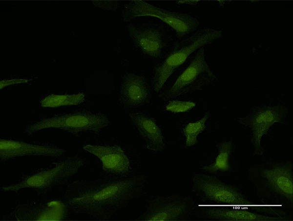 DDX6 Antibody in Immunocytochemistry (ICC/IF)