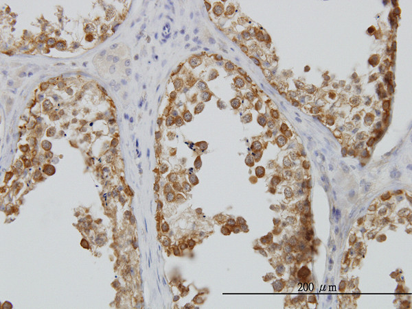 DDX6 Antibody in Immunohistochemistry (Paraffin) (IHC (P))